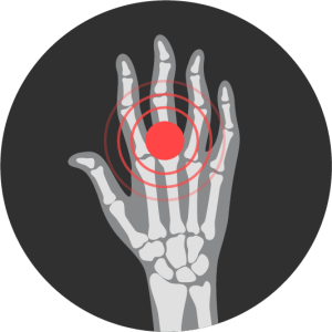 arthritis conditions we treat